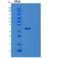 人蛋白信号调节因子20(RGS20)重组蛋白