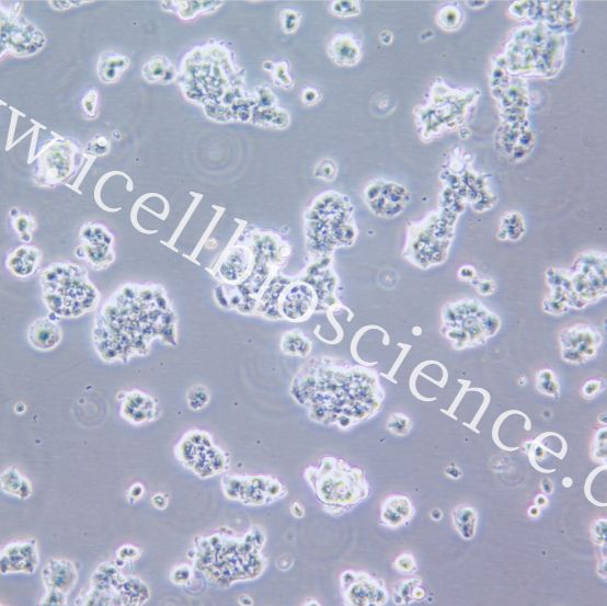 QGP-1 人胰腺癌细胞/STR鉴定/镜像绮点（Cellverse）
