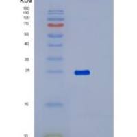 人RAB1B重组蛋白