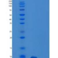 人调节激活正常T-细胞表达分泌因子(RANTES)重组蛋白