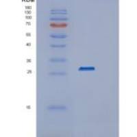 人RAB3A重组蛋白