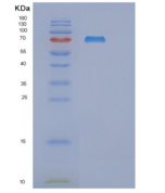 人mRNA-capping enzyme (RNGTT)重组