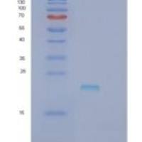 人RCAN3重组蛋白