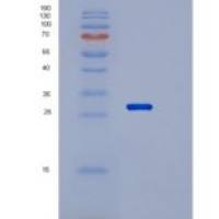 人RAB21重组蛋白