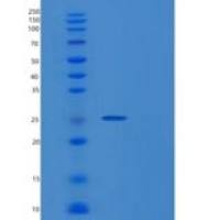 人RANBP3重组蛋白