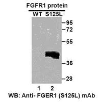 FGFR1(S125L)