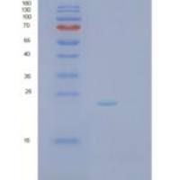 人Rho相关GTP结合蛋白RhoD(RhoD)重组蛋白