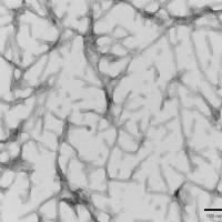 Tau441(2N4R), P301S 突变蛋白 PFFs
