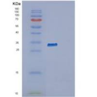 人RAB34重组蛋白