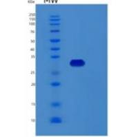 人RCHY1重组蛋白