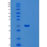 人REV1同源物(REV1)重组蛋白