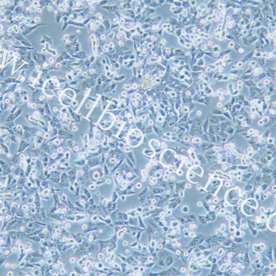HCT116+GFP 人结肠癌细胞绿色荧光标记