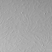 人心肌成纤维细胞