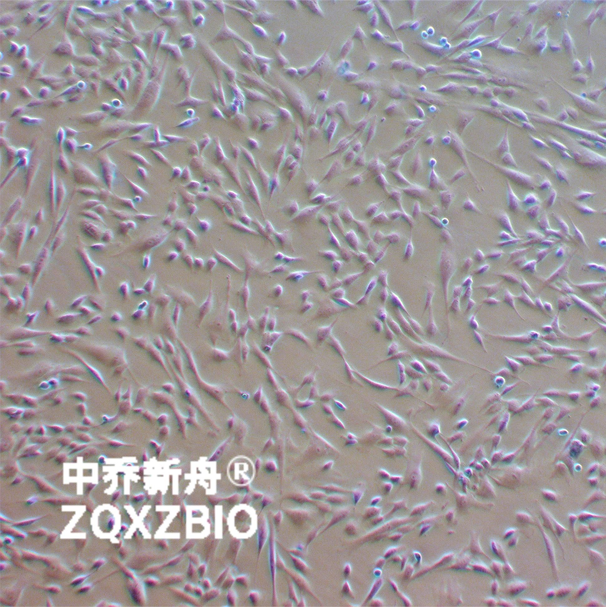 人脐静脉血管平滑肌细胞(p1冻存)