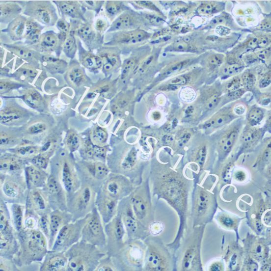 KMH2 人甲状腺癌细胞/STR鉴定/镜像绮点（Cellverse）