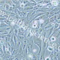 KMH2 人甲状腺癌细胞/STR鉴定/镜像绮点（Cellverse）