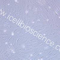 SNU-387 人肝癌细胞/STR鉴定/镜像绮点（Cellverse）