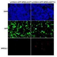 NFE2L2 (D77V)