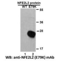 NFE2L2 (E79K)