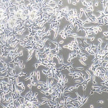 LNCaP 人前列腺癌细胞/STR鉴定/镜像绮点(Cellverse)