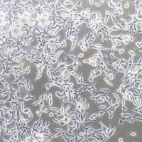 LNCaP 人前列腺癌细胞/STR鉴定/镜像绮点（Cellverse）