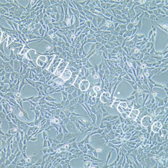 RENCA+luc 小鼠肾癌细胞稳定表达荧光素酶/镜像绮点（Cellverse）