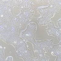 RT-4细胞 | RT4细胞 | RT-4 | RT4 | 人膀胱移行细胞乳头瘤 | STR鉴定 | 镜像绮点（Cellverse）