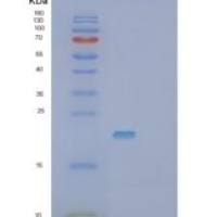 人SCN3B重组蛋白