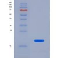 人补体1抑制因子(C1INH)重组蛋白