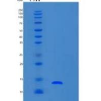 人S100钙结合蛋白A7(S100A7)重组蛋白