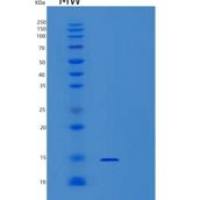 人硒蛋白X1(SEPX1)重组蛋白