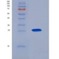 人精氨酸/丝氨酸丰富剪接因子1(SRSF1)重组蛋白