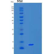 人S100钙结合蛋白A16(S100A16)重组蛋白