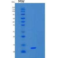 人S100钙结合蛋白A16(S100A16)重组蛋白