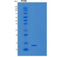人SAMD13重组蛋白