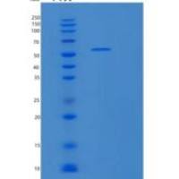 人分泌粒蛋白Ⅲ(SCG3)重组蛋白