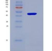 人抗凝血酶(AT)重组蛋白