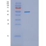 人生精蛋白Ⅰ(SEMG1)重组蛋白