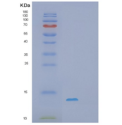 人S100钙结合蛋白A10(S100A10)重组蛋白