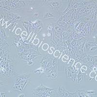 NCI-H2228 人肺癌细胞/STR鉴定/镜像绮点（Cellverse）