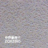 MHCC97-H人肝癌细胞（高转）