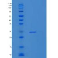 人核糖体蛋白S5(RPS5)重组蛋白