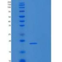 人RPS14重组蛋白