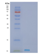 人SHFM1重组蛋白
