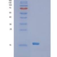 人含SH2域蛋白1A(SH2D1A)重组蛋白