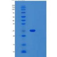人SAR1A重组蛋白