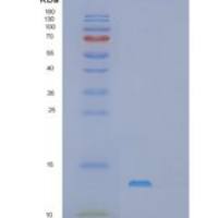 小鼠S100钙结合蛋白A1(S100A1)重组蛋白