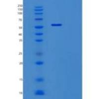 人SERPIND1重组蛋白