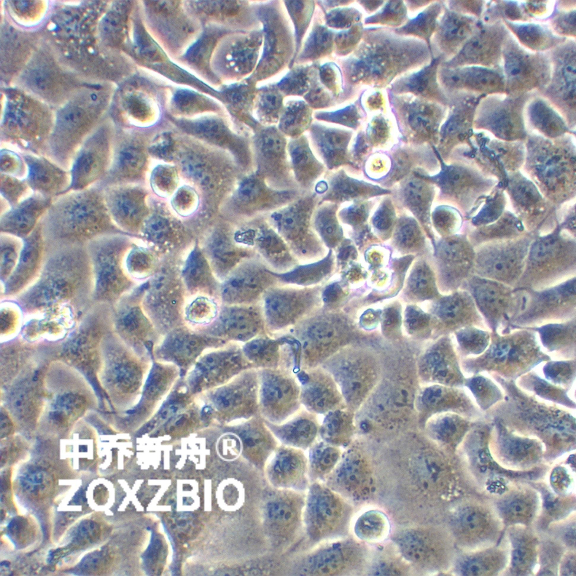 SHZ-88大鼠乳腺癌细胞