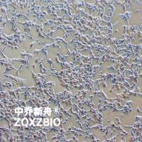 95-D人肺癌细胞(高转)